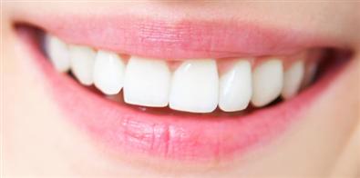 SO SÁNH RĂNG SỨ CERCON VÀ RĂNG SỨ KIM LOẠI