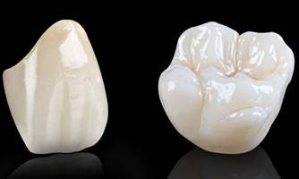 Tại sao nên chọn răng sứ Cercon để phục hình răng bị mất ?