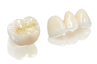Sứ Cercon