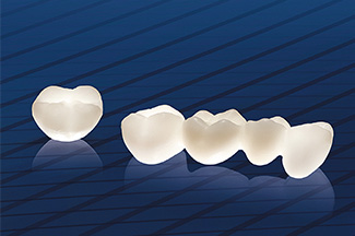 Sứ Cercon HT