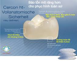 Full Cercon HT